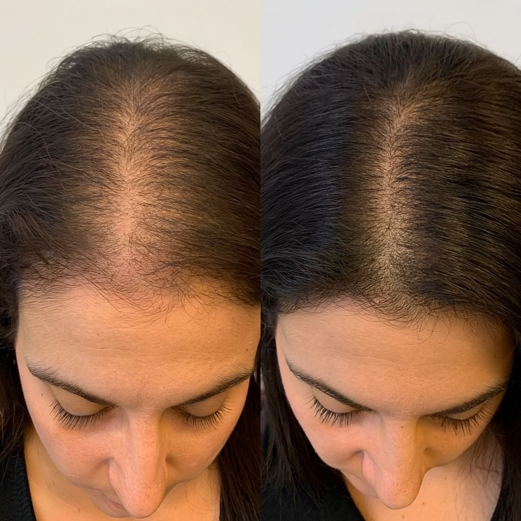 Hair serum - anti-hair loss, extreme growth and density
